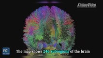 Chinese researchers have announced progress in personalized brain mapping, which gives a picture of the brain in ever-greater detail. Such a map will mark a gre