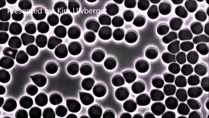 Live Blood Analysis What`s in Your Blood? Microscopy