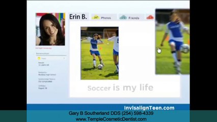 Clear Aligners Temple TX