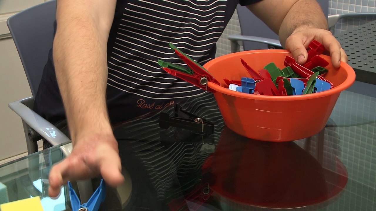 Vida "normal" después de trasplantar dedos del pie a la mano