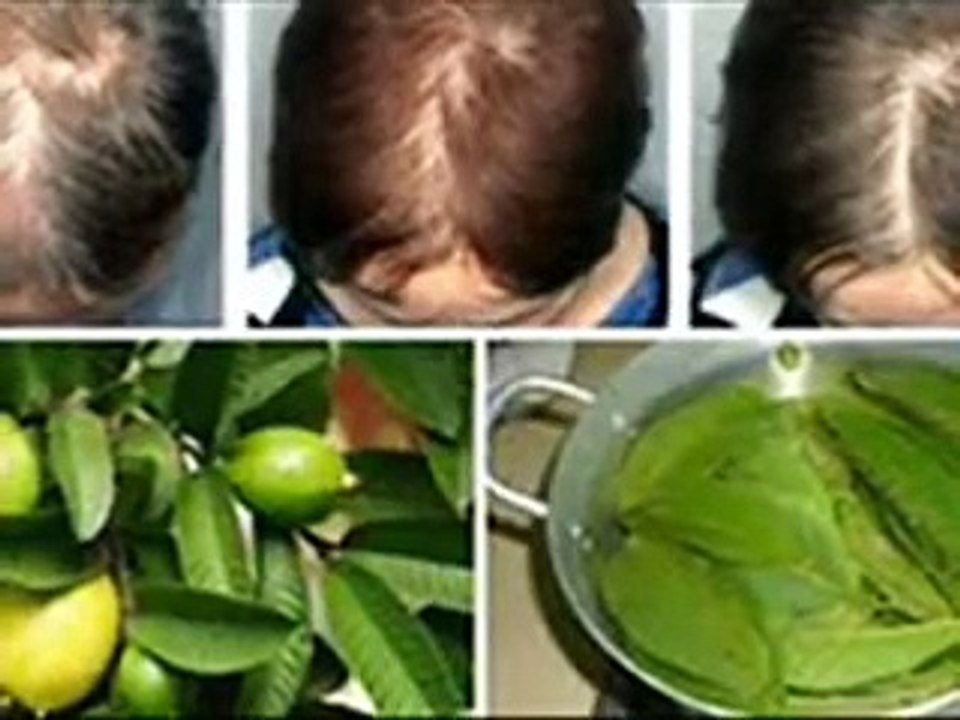 Cara Ampuh Melawan Rambut Rontok Dengan Daun Jambu Biji