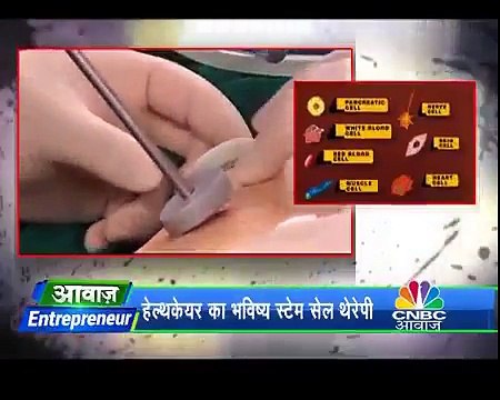 Advancells Stem Cell Therapy in India