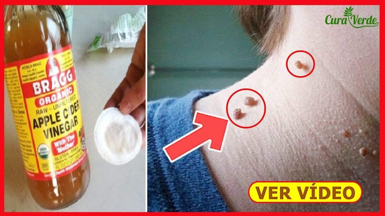 Remedio MÁGICO Contra INSÔNIA ➜ Coloque Embaixo da Língua e DURMA em Minutos...