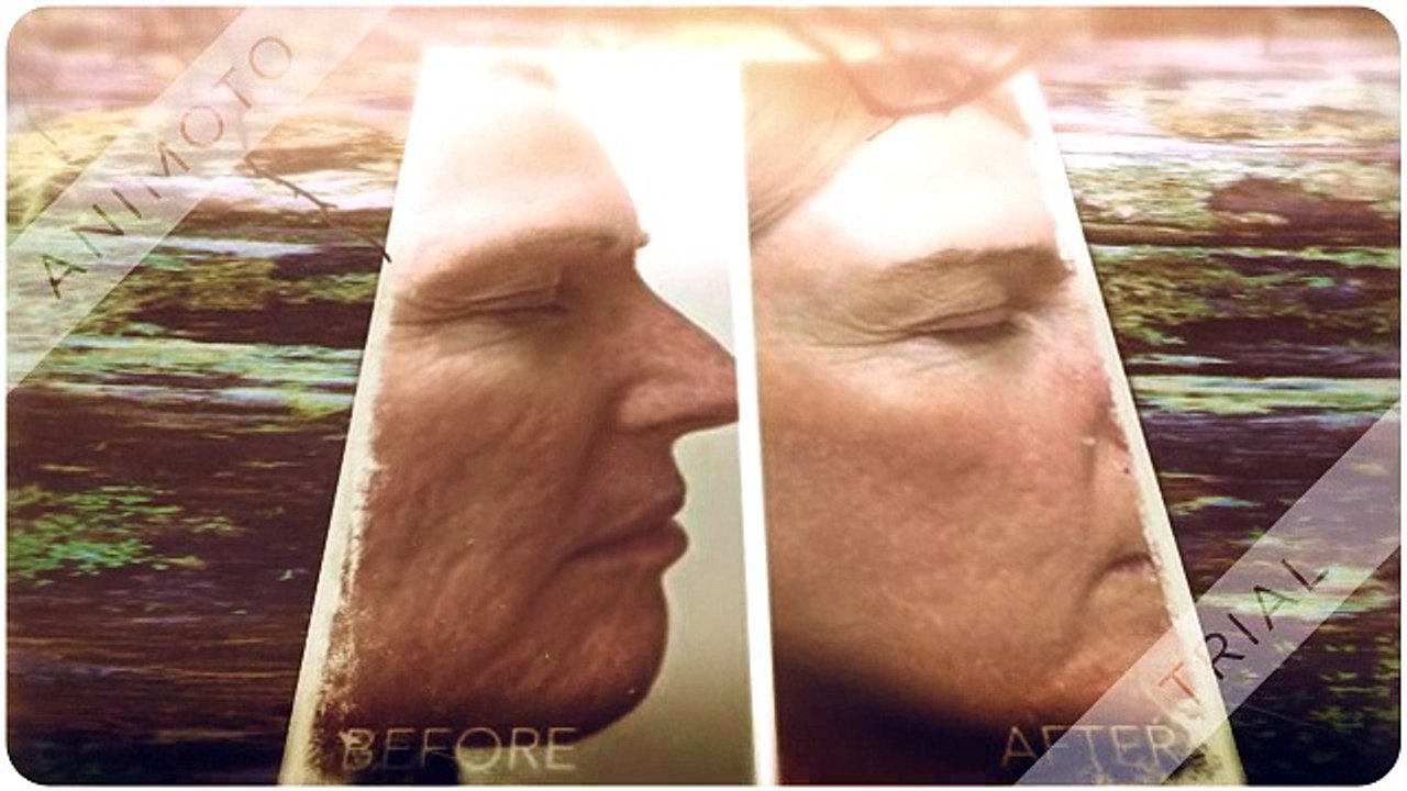 Bioderm RX
