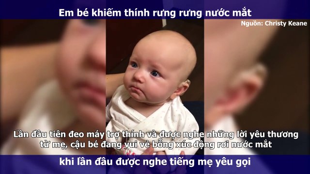 Em bé khiếm thính rưng rưng nước mắt khi lần đầu được nghe tiếng mẹ gọi Con yêu ơi!
