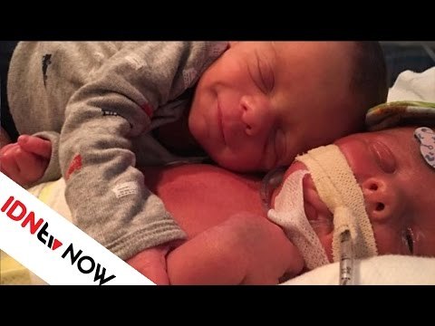 Foto Bayi yang Memeluk Kembarannya saat Kritis Ini Akan Membuatmu Terharu | IDNtv NOW