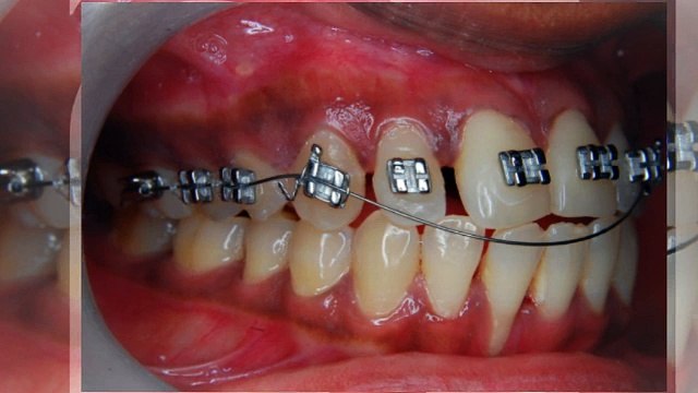 Orthodontist North Las Vegas