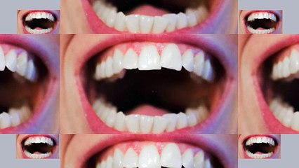 Summerlin Orthodontist