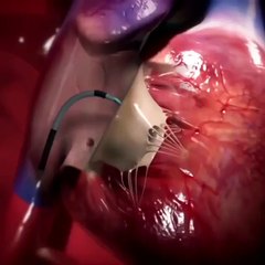 This super-thin temporary tattoo can monitor your health