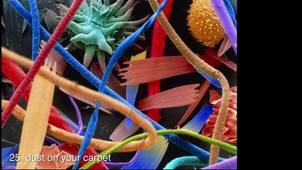 30 amazing electron microscopic images - micro universe