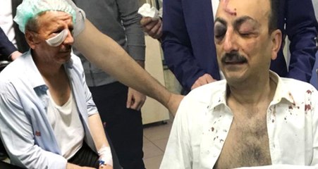 Ağzımıza Silah Dayadılar Diyen SP'lilere MHP'den Yanıt Geldi: Bize Ateş Açtılar