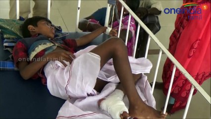 நாட்டு துப்பாக்கி வெடித்து சிறுவன் படுகாயம்