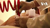 شمار از مردم در افغانستان برای پاکسازی خون بدن ، پیشگیری از بروز بیماری ها و تسکین شماری از دردها ؛ از روش درمانی سنتی حجامت یا خونگیری استفاده میکنندمعصومه حی