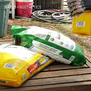 These custom prostheses give amputees better motor capabilities