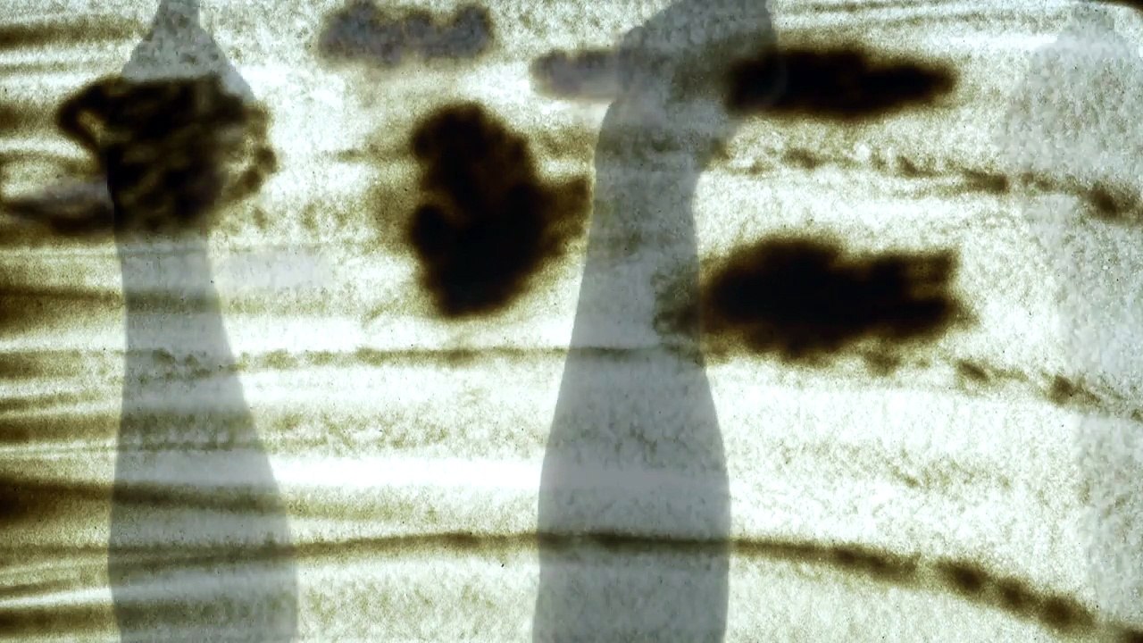 HIVAIDS için tedbir sizsiniz