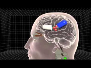 Male contraceptive pill may be possible within 10 years