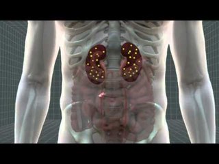 Mexico Castaway ― How chronic dehydration damages the human body