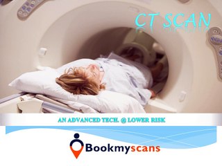 Important facts, procedure & real cost of CT Scan you should be aware of.