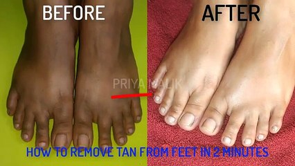 HOW TO REMOVE SUN TAN FROM FEET