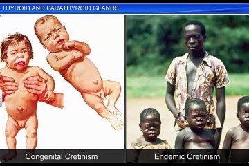 (3)CBSE Class 11 Biology, Chemical Coordination and integration – 3, Thyroid and Parathyroid Glands