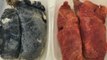 Johannesburg PSA Shows Smoker's Lungs vs Healthy Lungs for World No Tobacco Day