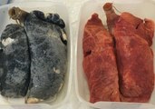 Johannesburg PSA Shows Smoker's Lungs vs Healthy Lungs for World No Tobacco Day
