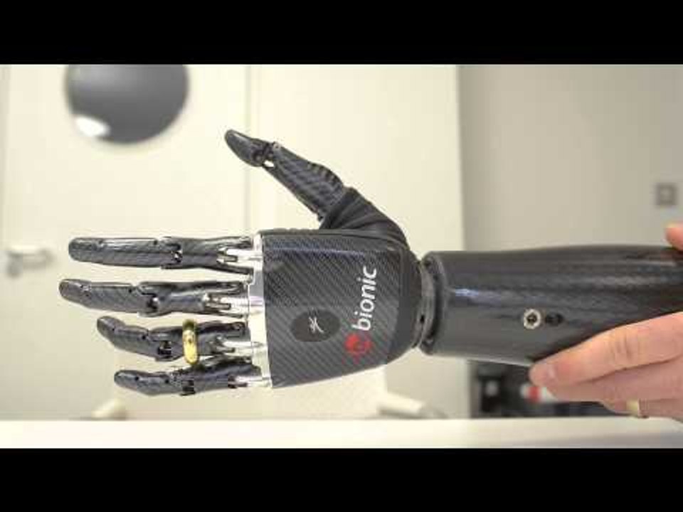 Terminator arm customised to wear wedding ring