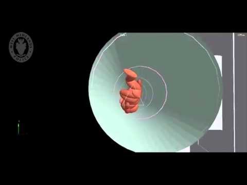 3d reconstruction after mum hurled her six-day-old baby down a 44ft RUBBISH CHUTE