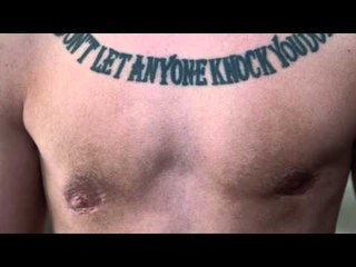 Transgender male faces big operation