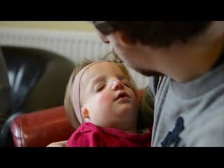 New dad with severe facial disfigurement defends decision to have daughter naturally