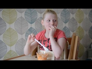 11 year-old has permanent smile - due to rare genetic condition