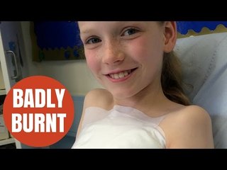 Nine-year-old girl suffers horrific burns filling up hot water bottle