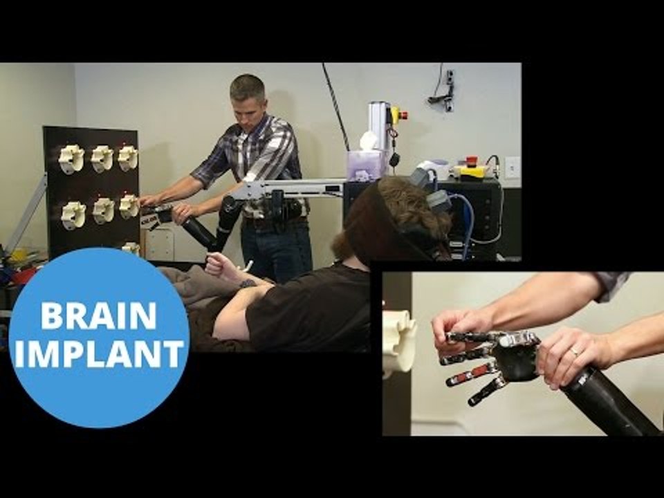 Brain Implants Can Help Restore Feeling To Paralysed Hands
