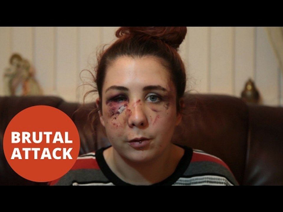 Autistic 16yo girl left with horrific facial injuries after battered by yob
