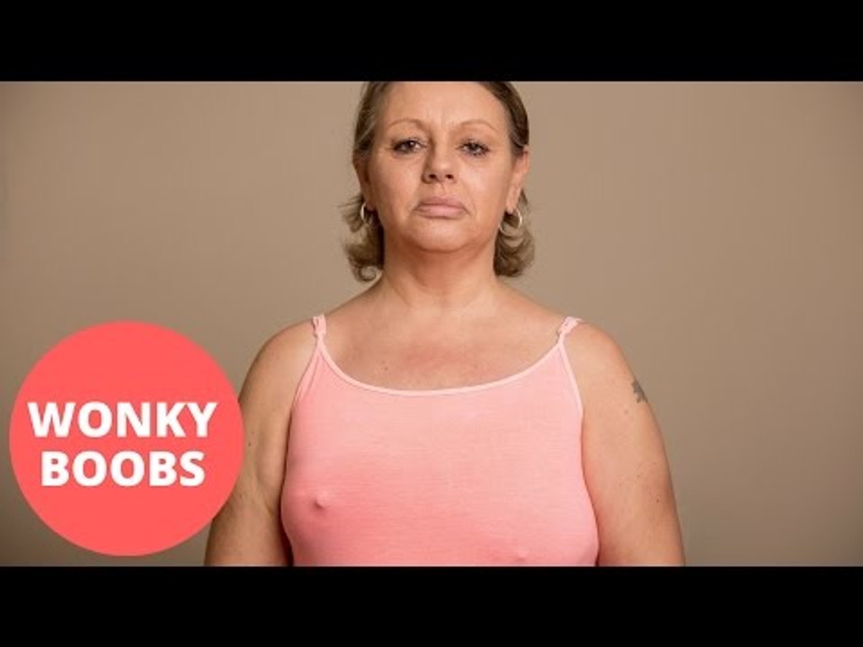 Breast cancer sufferer left with differently shaped boobs after mastectomy