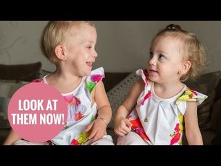 Miracle twin sisters born HOURS away from the abortion deadline