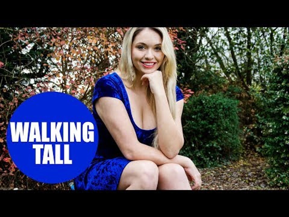 Woman who was bullied for eczema and psoriasis becomes model