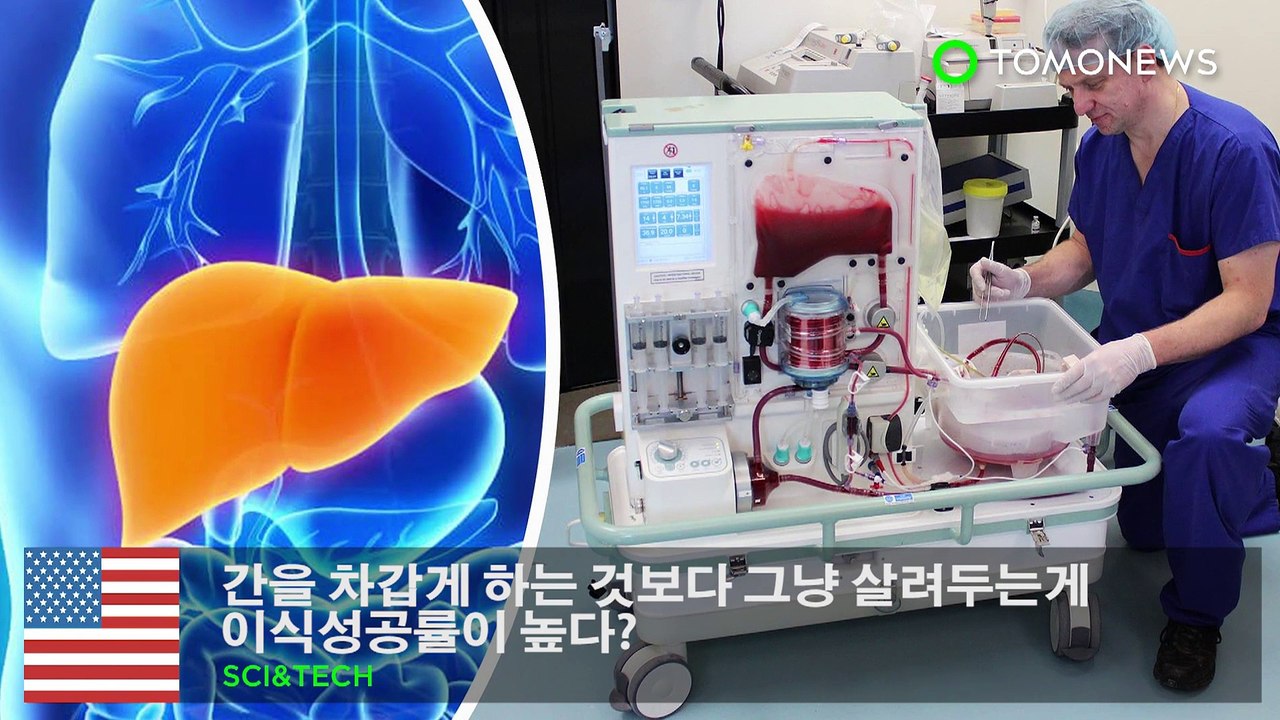 간을 차갑게 하는 것보다 따뜻하게 두는 것이 이식성공률이 높다?