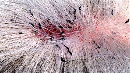 Son anti-ultrasons anti-poux - 30 minutes