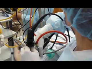 Удаление полипов. Малоинвазивная лор-операция. КЛИНИКА ПЕРЕВЕРЗЕВОЙ.