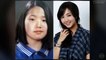 50 Korean Plastic Surgery Before and After Photos