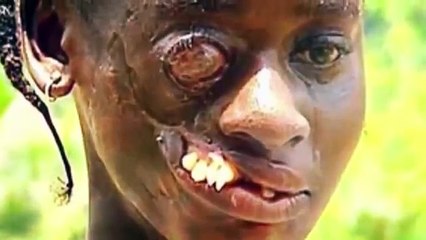 Самые СТРАШНЫЕ БОЛЕЗНИ в мире!