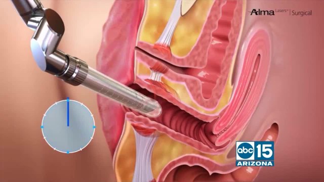 Nuvell Clinics offers ways to improve your sexual health