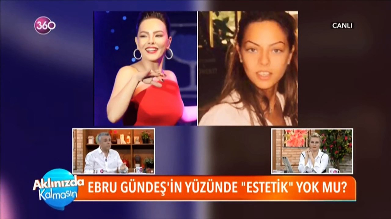 Ebru Gündeş Yüzüme Sadece Botoks Yaptırdım Estetik Yok