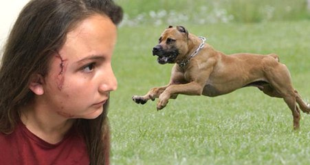 Çocuk Parkında Dehşet! 12 Yaşındaki Çocuğu Pitbullun Dişlerinden Zor Kurtardılar