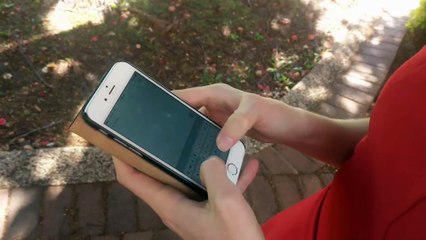 Elle dévoile la malformation de sa main