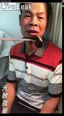 Un VER vivant dans le nez : ce chinois passe chez le médecin !