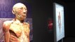 Whoa! See 200 bodies, body parts at Arizona exhibition