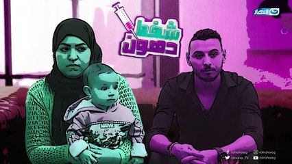 Shaft Dohoon - Episode 20 | شفط دهون - الحلقة 20  العشرون