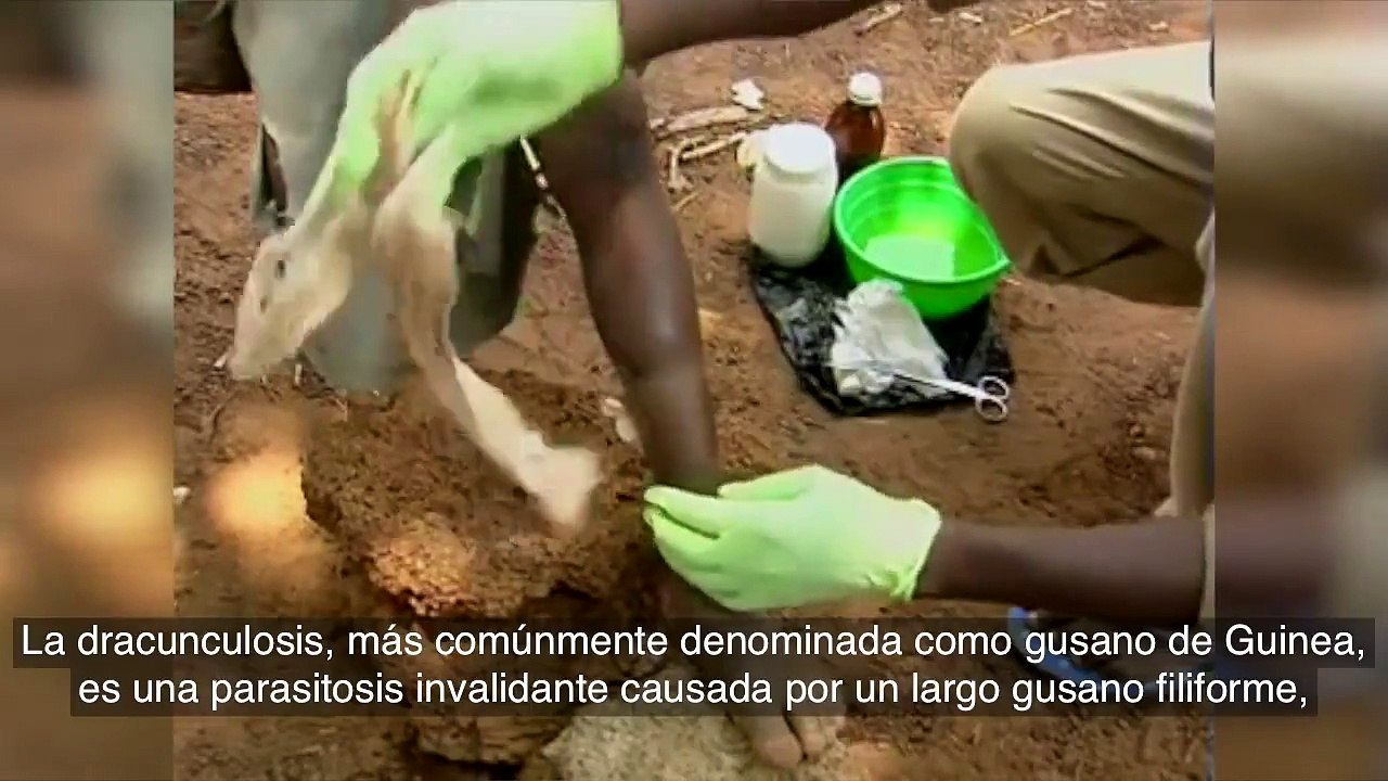 La dracunculosis, cuando un gusano parásito entra y se desarrolla en el cuerpo humano